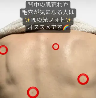 脱毛SALON RaYNiCKのエステ・リラクイメージ