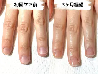 ネイル Ka pilina所属・自爪育成専門店 Kapilinaのネイルデザイン