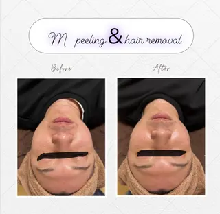 ピーリング＆脱毛 maoのエステ・リラクイメージ