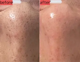 Beauty SalonViolaのエステ・リラクイメージ