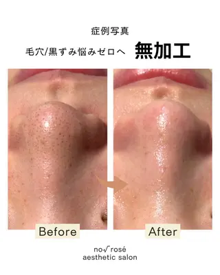 ノールート ロゼのエステ・リラクイメージ