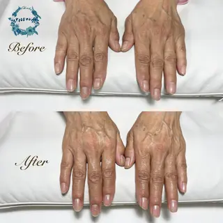 ネイル roconail ヒロコのネイルデザイン