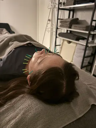 美容鍼×小顔矯正 ×美容整体　浜川泰仁のエステ・リラクイメージ