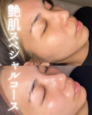 private beauty salon Lilby所属・リルビー 肌育・肌質改善サロンのその他イメージ