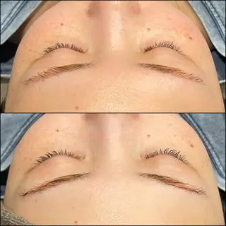 LiZA エステティックサロンのエステ・リラクイメージ