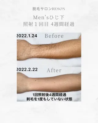 メンズ RESON 調布店所属・都度払いの脱毛サロン RESONのエステ・リラクイメージ