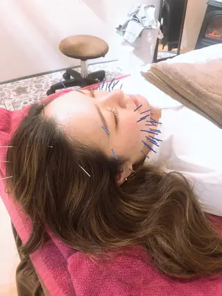 美容鍼灸女性専用 りんご鍼灸治療院のその他イメージ