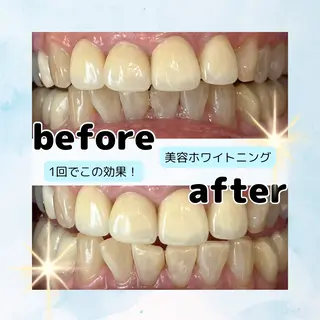 ホワイトニングサロン Soleilのその他イメージ