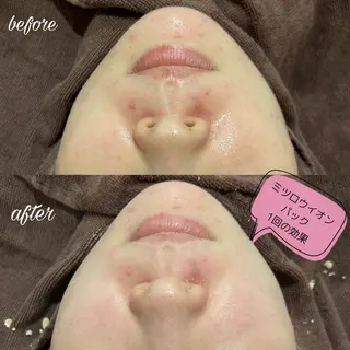 merveilles所属・まつげ/整体/にきび ・アトピー専門サロンのマツエク・マツパデザイン