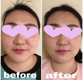 美容鍼灸女性専用 りんご鍼灸治療院のその他イメージ