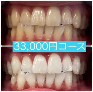 PLATINUM Beauty 横浜店所属・ホワイトニングルーム 横浜店のその他イメージ