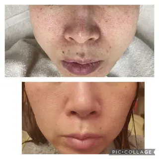 ネイル マツエク・マツパ アイブロウ total beauty  salon RIRE所属・古川 弥生のエステ・リラクイメージ