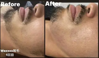 メンズ Epina 千葉店 【エピナ】のエステ・リラクイメージ