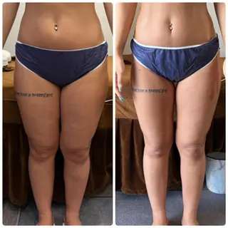 FLEUR大阪・整体 ・ハイフ・痩身・小顔のエステ・リラクイメージ