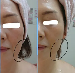 小顔と腸の専門店 ラクーラビューティのエステ・リラクイメージ