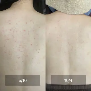 BeautySalon　Eclaleum所属・Eclaleum MAIのエステ・リラクイメージ
