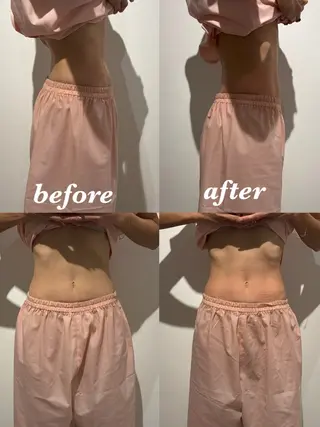 メンズ 腸活サポート みなみののエステ・リラクイメージ