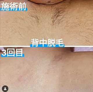 メンズ 姫路御立脱毛サロンSClass.所属・姫路御立脱毛サロン S Class.のエステ・リラクイメージ