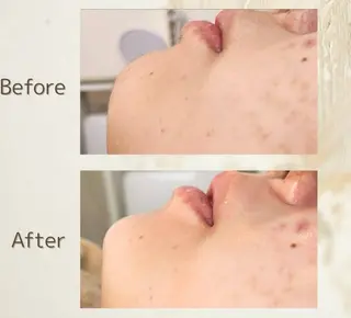 &W アンダブルのエステ・リラクイメージ