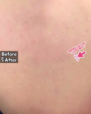 Hit. シュガーリング豊橋のエステ・リラクイメージ