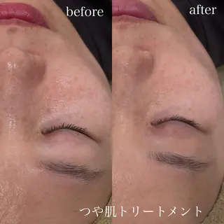 Re.Grace所属・Re.Grace片野 由茉のエステ・リラクイメージ