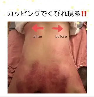 ドライヘッドスパ KilaKilaのエステ・リラクイメージ