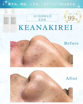 Liam《美肌管理/ 3D小顔/脂肪ケア》のエステ・リラクイメージ