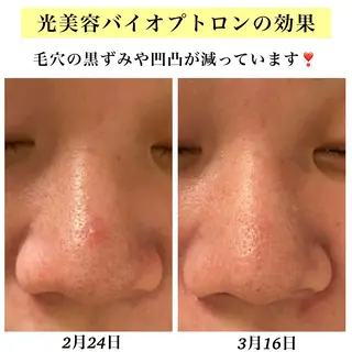 Bellesthe （ベルエステ）のエステ・リラクイメージ