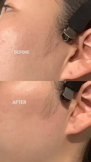 メンズ アイブロウ iBROW. 熊見怜奈の眉毛・アイブロウイメージ