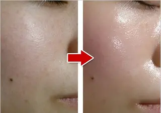 千葉中央/まつげ 大会日本一獲得のマツエク・マツパデザイン