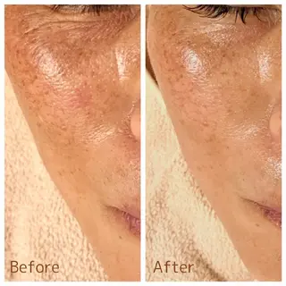 フェイシャル専門サロ ン ERINのエステ・リラクイメージ