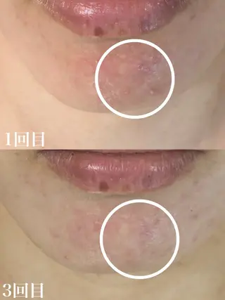 WHITE AQUA 北千住店のエステ・リラクイメージ