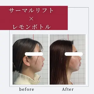 小顔矯正専門店 ❤️池田 桃花のエステ・リラクイメージ