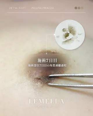 NAIL＆EYELASH SALON Lovers MOMO ～ラヴァーズ モモ～所属・Lovers MOMOのエステ・リラクイメージ