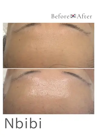 韓国🇰🇷価格 サロン_Nbibiのエステ・リラクイメージ