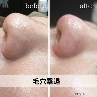 ECXIA 【エクシア】のエステ・リラクイメージ