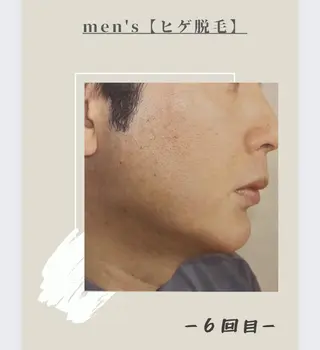 メンズ 女性専用脱毛サロン エンジェルナンバーのエステ・リラクイメージ