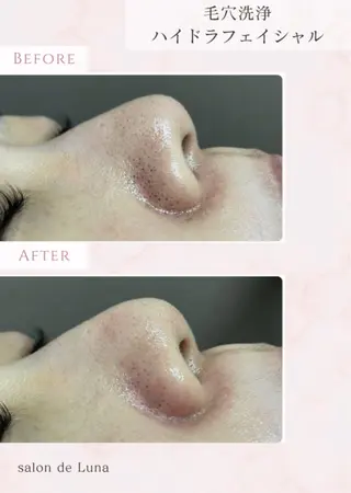 salon de Lunaのエステ・リラクイメージ