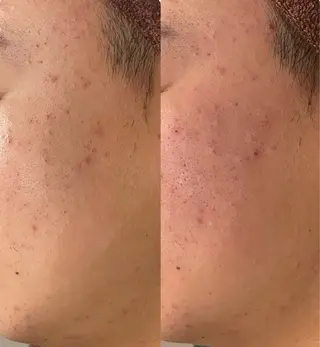 お肌のかかりつけサロンP.A.L.M.所属・【P.A.L.M.】 むき卵×毛穴レス肌のエステ・リラクイメージ