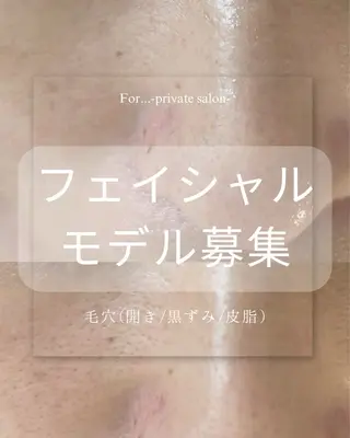 田中For..天王寺 肌質改善/よもぎ蒸しのエステ・リラクイメージ