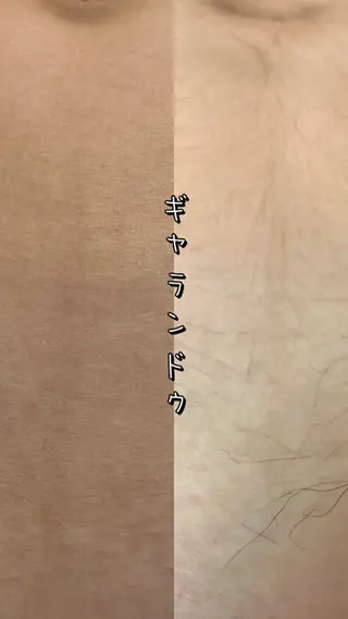 メンズ Hit. シュガーリング豊橋のエステ・リラクイメージ