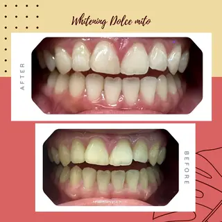 セルフホワイトニング Dolce水戸店のその他イメージ