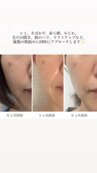 Avenir所属・Sakumoto Miuの眉毛・アイブロウイメージ
