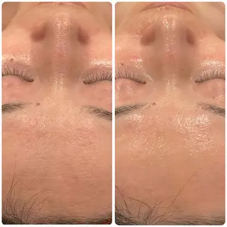 立体小顔×艶肌×美ボ ディ似合わせ施術 岡のエステ・リラクイメージ