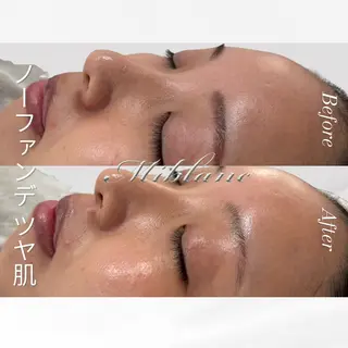 肌質管理 MIBLANC上野店のその他イメージ