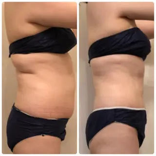 FLEUR大阪・美容 整体・痩身・小顔のエステ・リラクイメージ