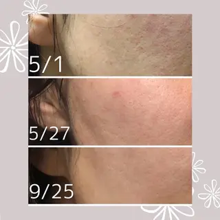 M MaKe yourself shine所属・プライベート脱毛 Jr久宝寺のエステ・リラクイメージ