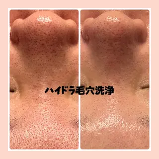 檜山 feliceのエステ・リラクイメージ