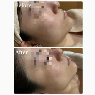 脱毛&フェイシャル 専門店muro.のエステ・リラクイメージ