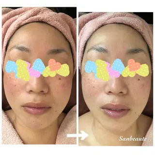 Sanbeaute サンボーテのエステ・リラクイメージ